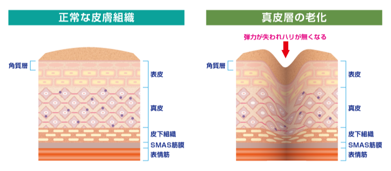 肌断面