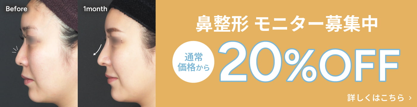 鼻整形 モニター募集中 通常価格から20%OFF