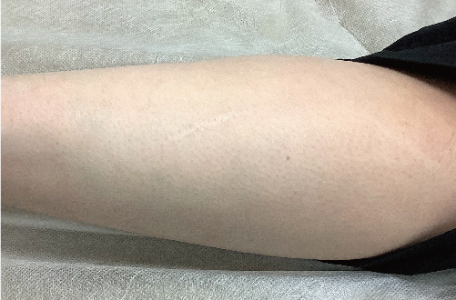 Skin52（30代｜女性）