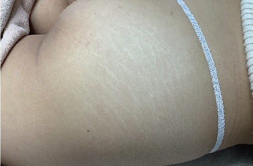 Skin52（20代｜女性）