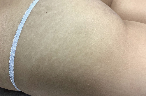 Skin52（20代｜女性）