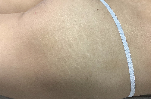 Skin52（20代｜女性）