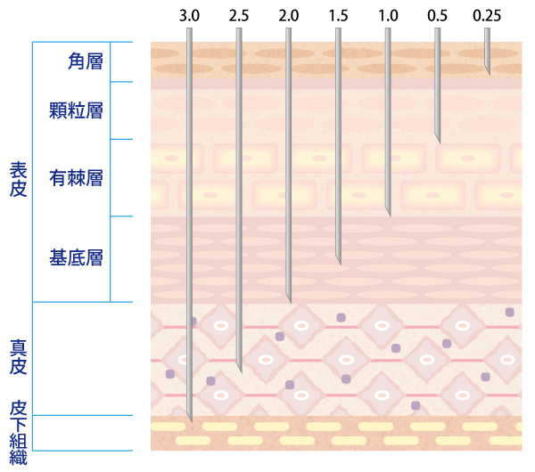 ダーマペンの仕組み