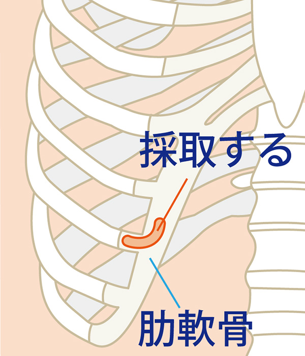 肋軟骨