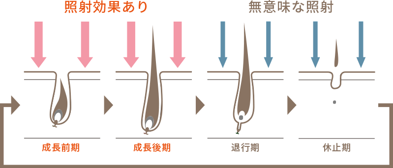 毛周期に合わせた照射が必要