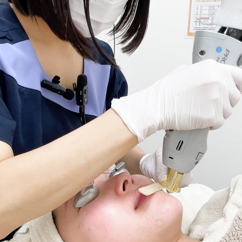その時に最適な出力で施術