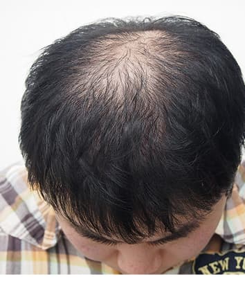 28歳男性 治療前