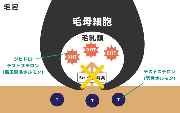 フィナステリドの画像