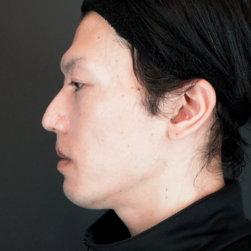 1ヶ月後