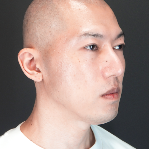 セットバック整形(30代|男性)6ヶ月後